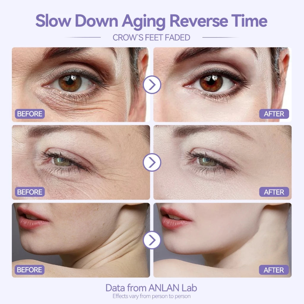 EMS Face Massager Multi-Polar Skin Firming V Shape Red Blue LED Light Therapy Face