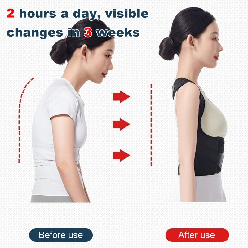 Adjustable Back Support Posture Corrector