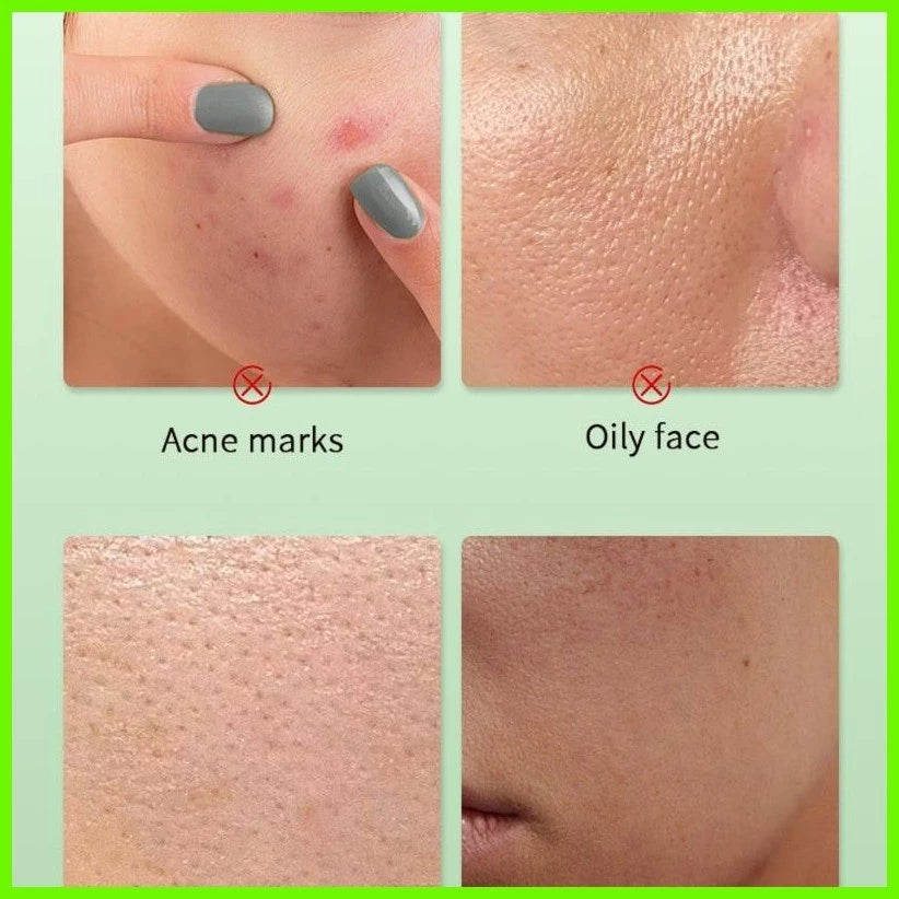 Brightening Skin Exfoliating Gel Chlorella Vulgaris Extraction for Gentle Cleansing