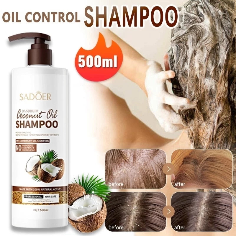 Hair Care Anti-Dandruff Intensive Moisture Coconut Shampoo