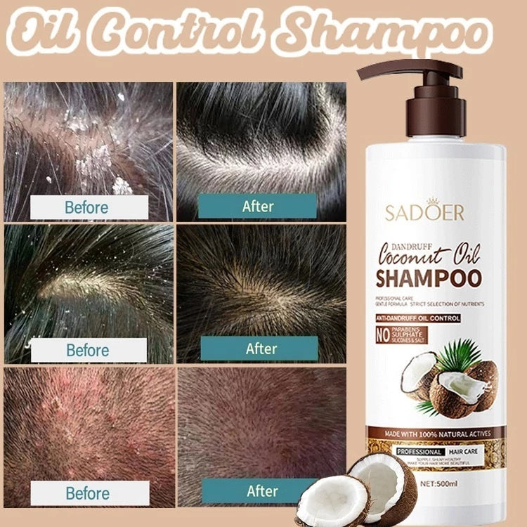 Hair Care Anti-Dandruff Intensive Moisture Coconut Shampoo
