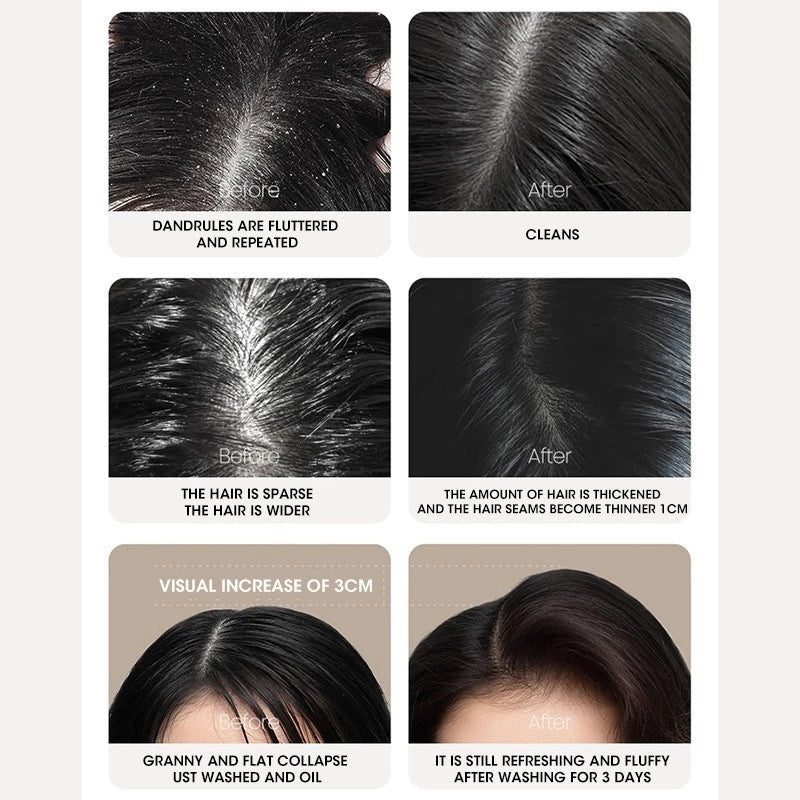 Hair Care Anti-Dandruff Intensive Moisture Coconut Shampoo